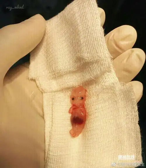 友友们帮帮忙,哪里做人流做的安全