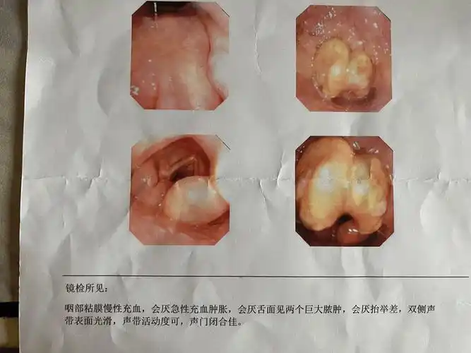 呼吸不畅危及生命当孕妇遇见喉炎因为朋友圈的评论救了一条人命