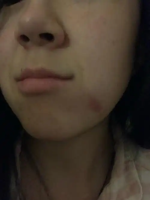 嘬身上也就算了,现在居然来嘬我脸,涂多少粉底都遮不住这深深的草莓印