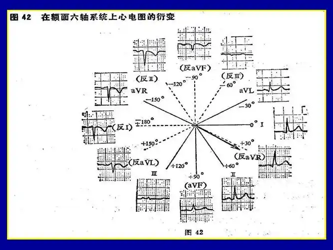 3-心电图第三课心电轴转位测量正常心电图及意义ppt