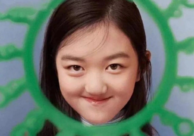 王菲小女儿治唇腭裂花费几百万,嘴是治好了,但脸型越长越奇怪了