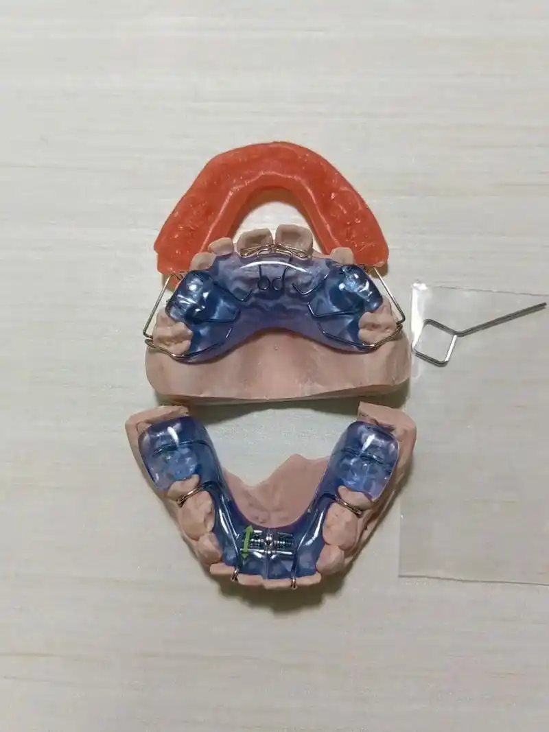 暑假来临,暑假放假两个月在家悄悄变美,各种各样儿童矫正器加工 - 抖