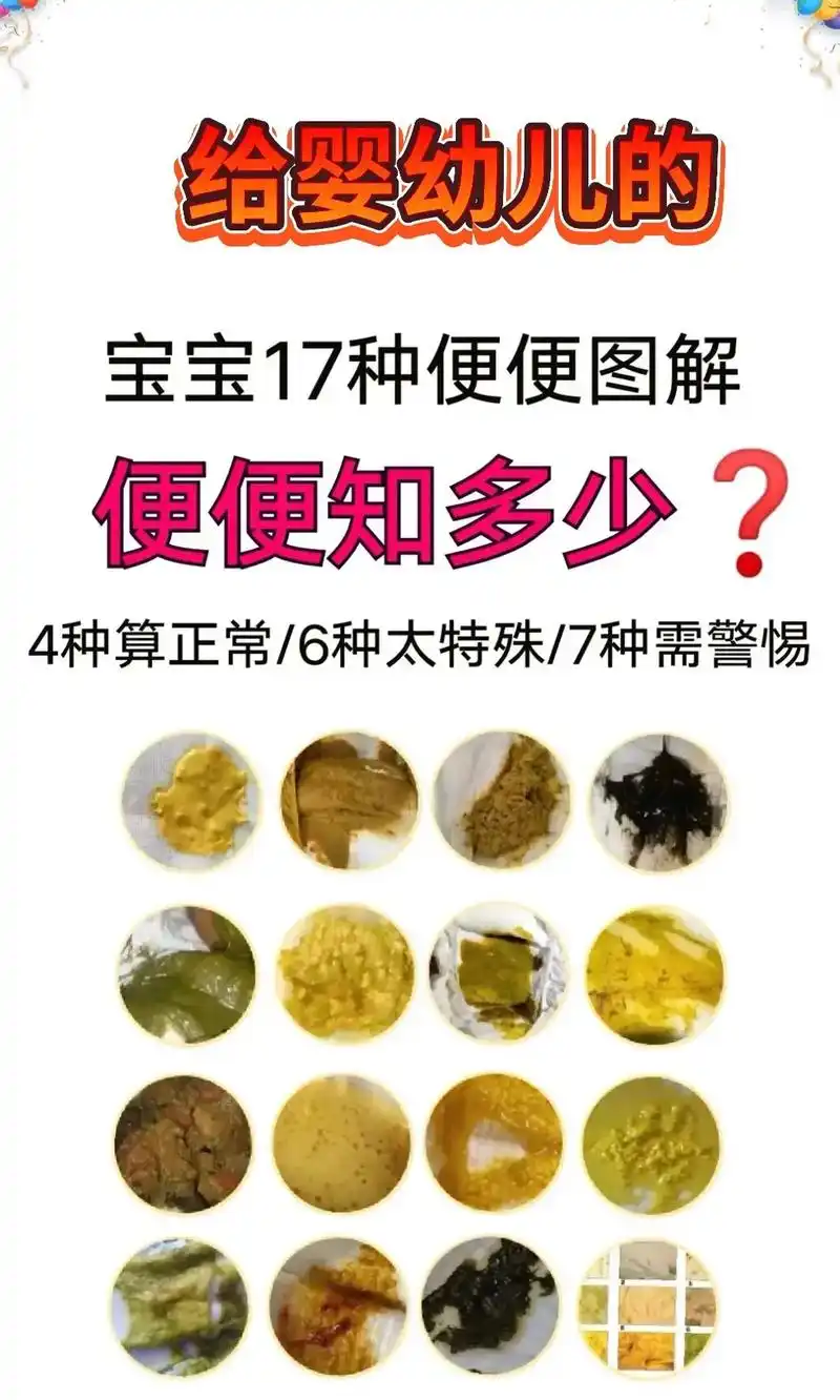 17种便便93.#母乳喂养心得 ##宝宝发育 #宝宝便便 # - 抖音