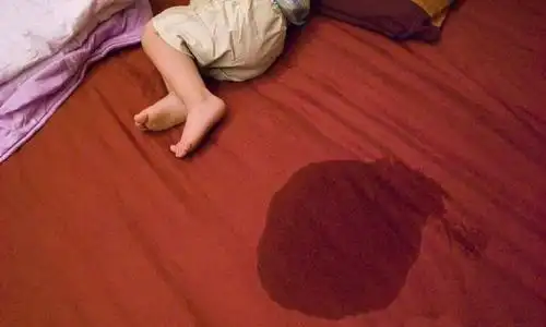 幼儿园孩子尿裤子,穿湿裤子几小时着凉感冒,家长积极应对是良策