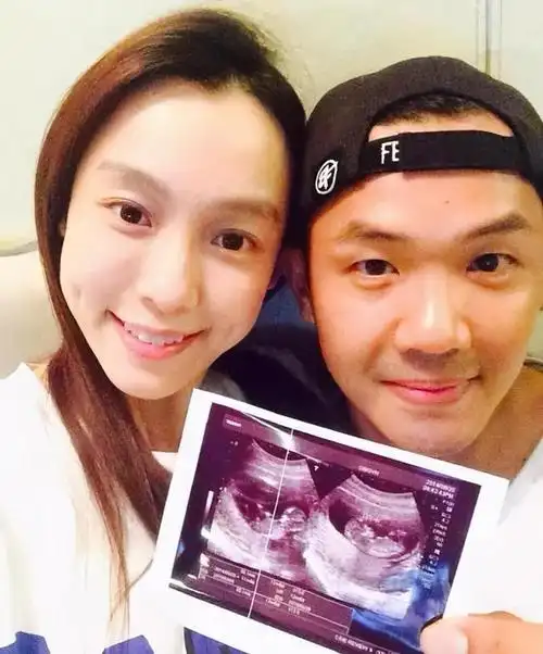 范玮琪产下双胞胎,这份好孕实在难得