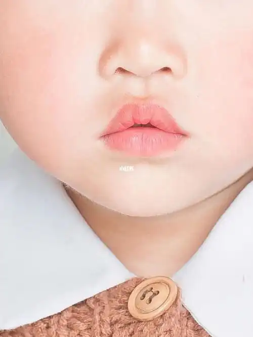 这是腺样体面容的嘴唇嘛