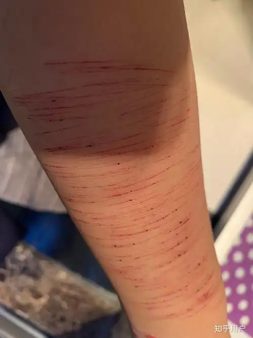 自残属于什么心理