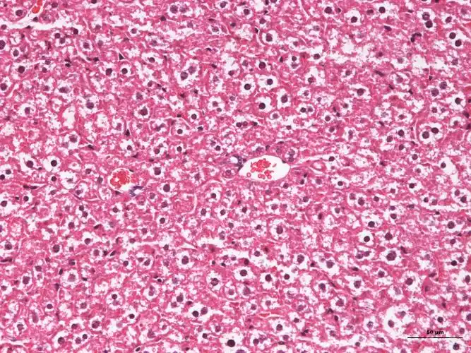 小鼠肝h&e染色图片,这些白色是脂肪变性或细胞肿胀吗?