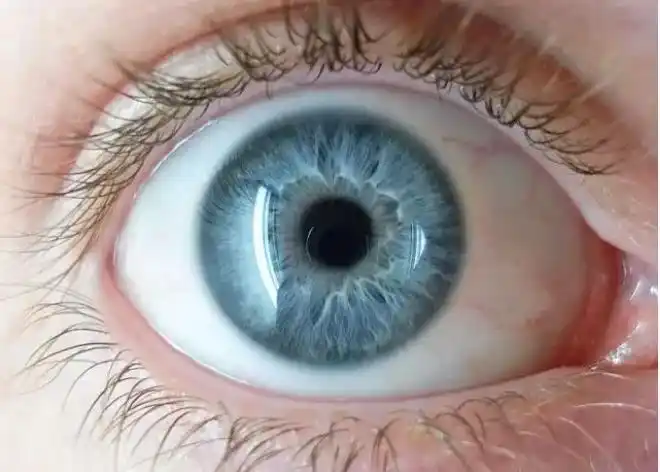 高度近视不可怕吗?这四个严重的并发症,或许谁都惹不起