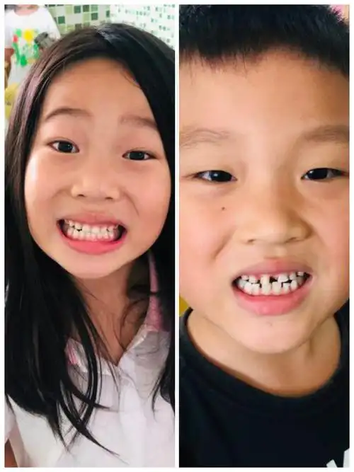 "爱护牙齿,从小做起,从我做起"——波斯顿幼儿园"爱牙日"活动