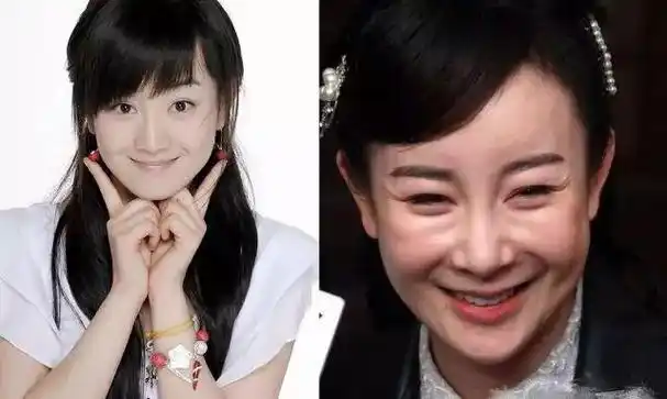 张檬整容历程 大起大落 结局亮了