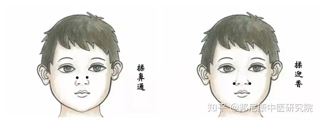 孩子鼻甲肥大,腺样体肥大,上颌窦炎全都有!