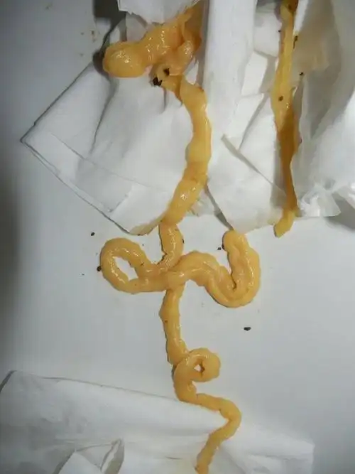 大便出一条大约30厘米长的虫子,这是什么虫?求回答