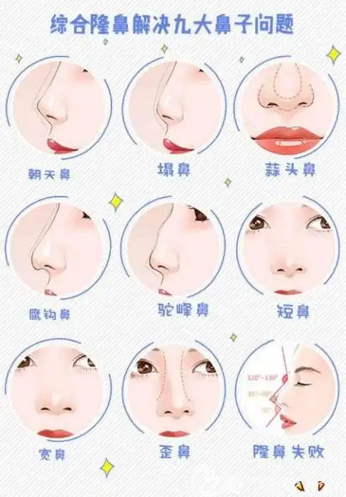 鼻综合为什么比单纯隆鼻效果更好看?