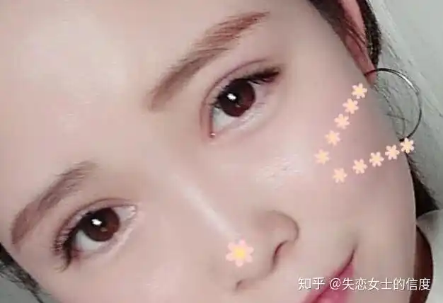 埋线和全切哪个好呀?