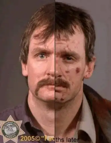 《吸毒before & after对比图》有些东西你绝对不能尝试