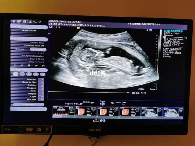 nt秒过姐妹们来接顺便帮我看看男女