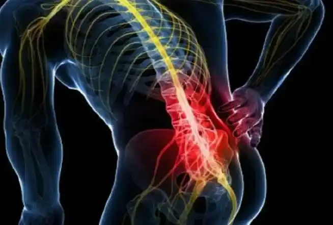 #腰椎间盘突出#