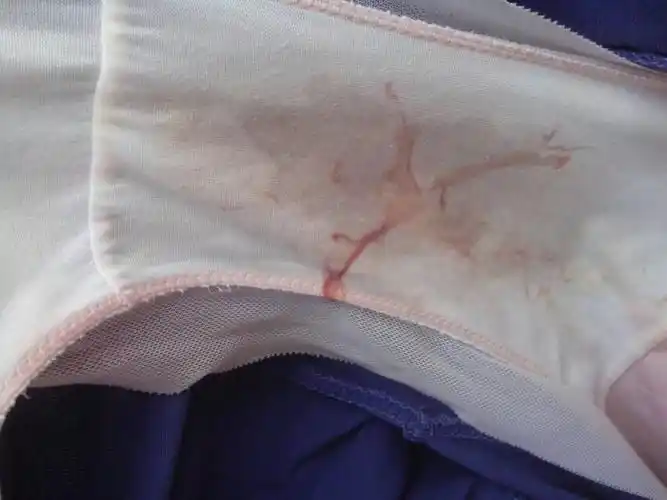 我月经过去了,白带里这样是怎么回事