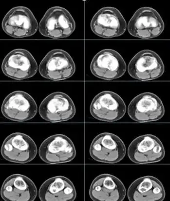 x光片ctb超核磁共振别傻傻的分不清医生告诉你