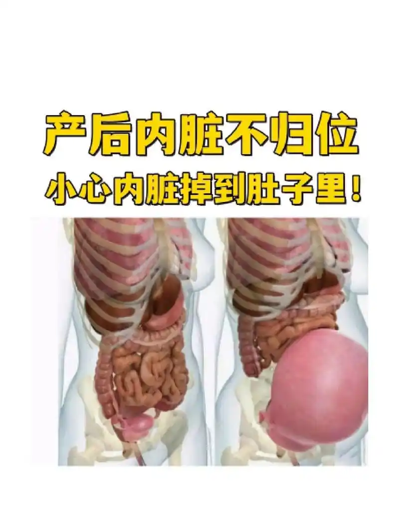导致产后妈妈几乎都有内脏脱垂的情况,同时由于肋骨外扩,也造成产后