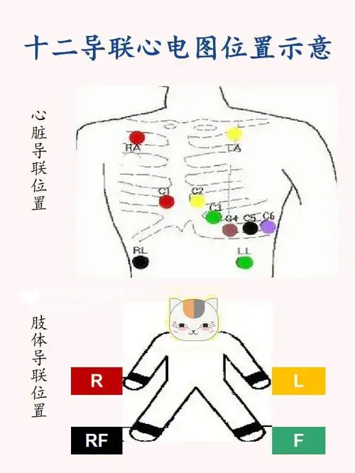 内科十二导联心电图示意
