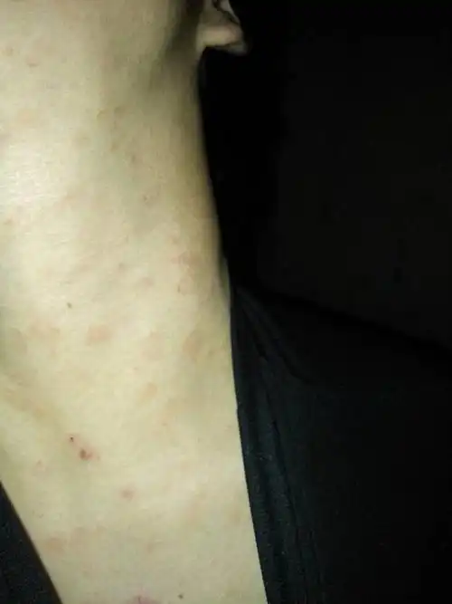 而且现在又有了一些黑色的东西.请问怎么办