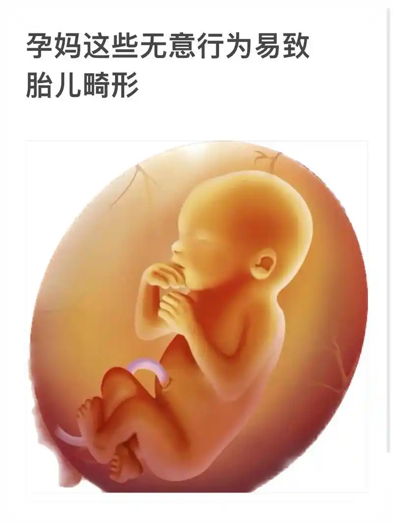 孕妈这些行为易致胎儿畸形,姐妹们避雷