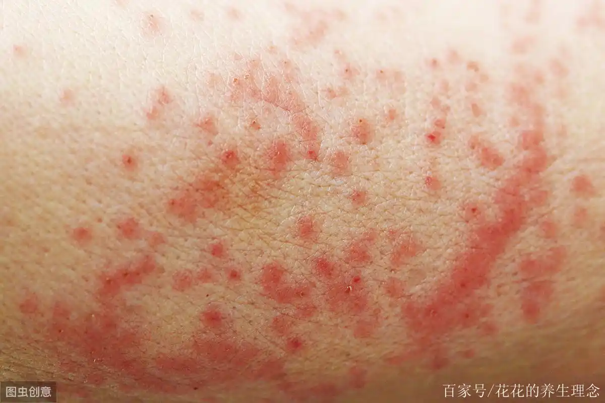 乳腺癌早期,别忽视4大"蛛丝马迹",你若占1个,趁早去检查