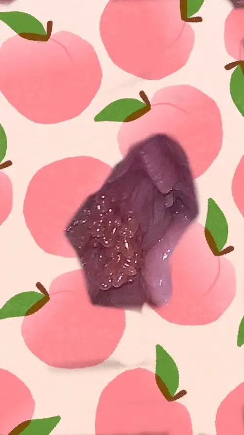 姐妹们帮我看看这是假性还是尖尖呢!(有图慎入)