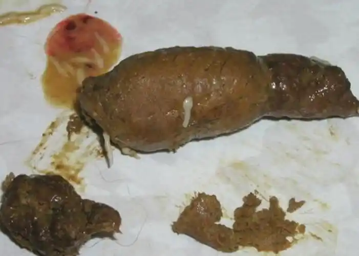 猫咪感染绦虫后的症状