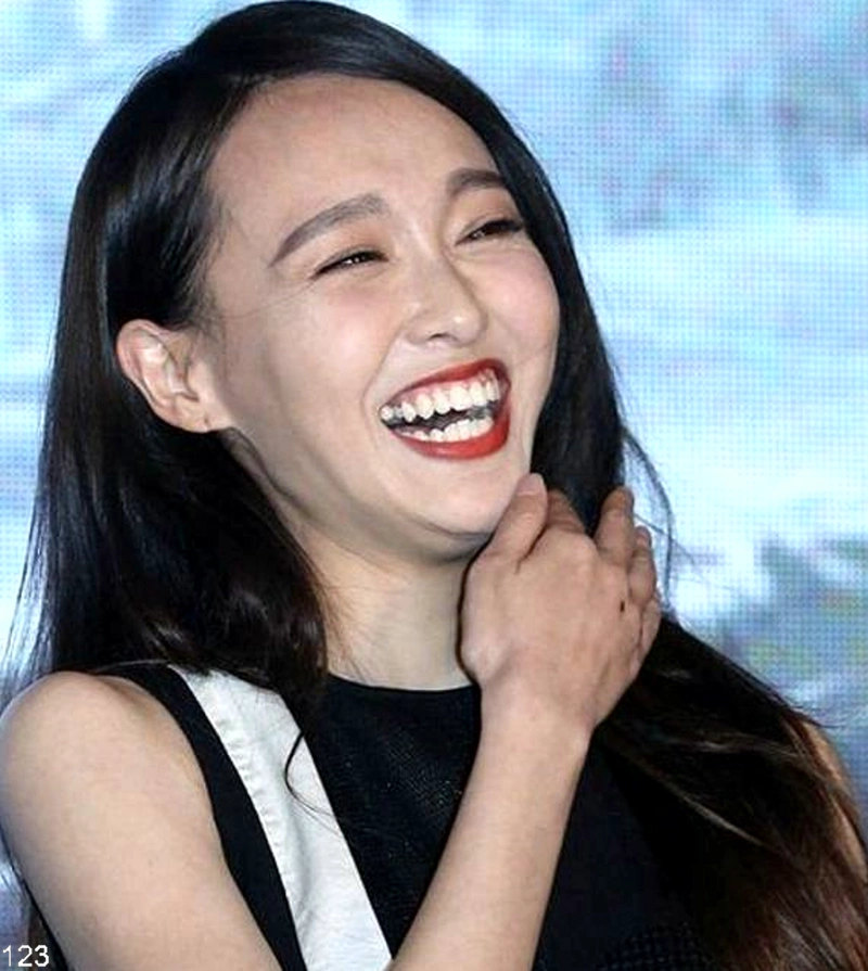 娱乐圈中爱张嘴大笑的女星,神仙姐姐的双下巴好抢镜!