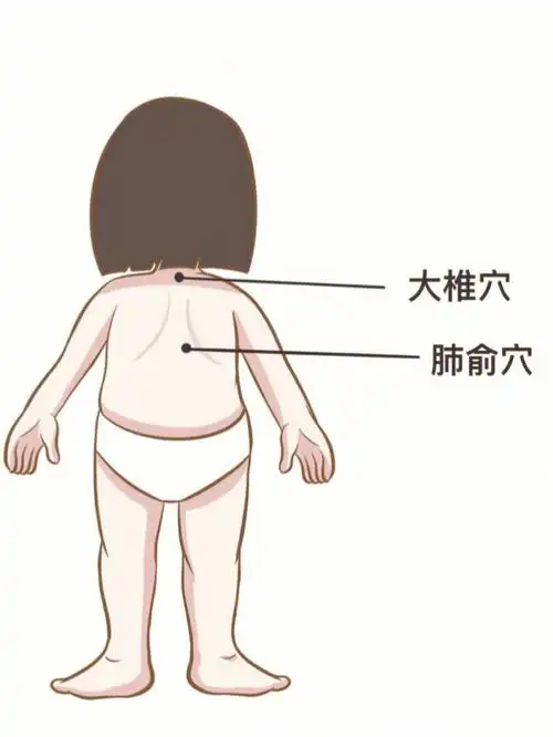 小儿咳嗽难愈Ⅰ试试灸这几个穴位