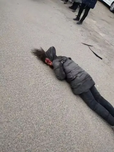 张北两名小女孩出车祸,生命垂危!