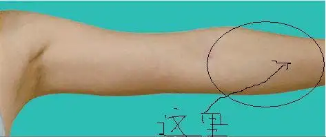 上手臂内侧中间疼怎么回事