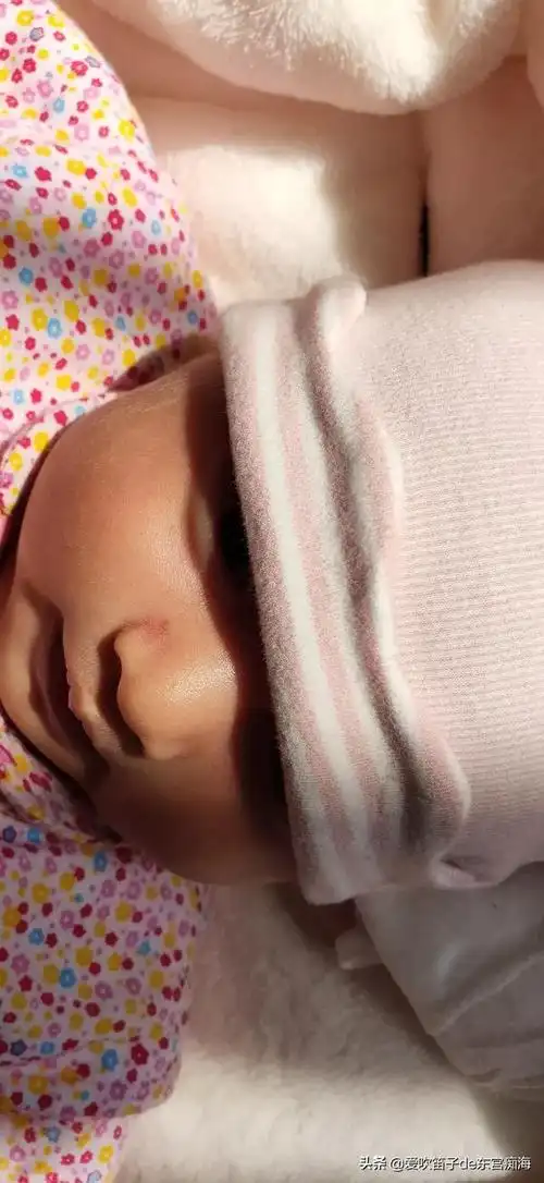 宝宝臀部中间有个小坑,医生:大部分是正常情况