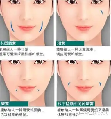 按照位置来看,应该是属于酒窝了,个人有个人的特点,跟标准不一定是一