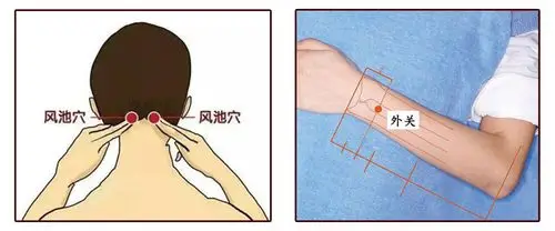 面瘫看看中医怎么说怎么用艾灸有效治疗