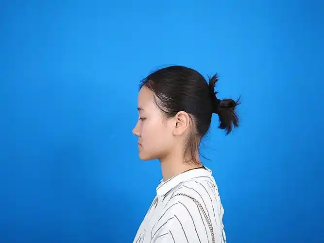 从小就觉得我的鼻子不好看,有点朝天鼻,侧面看的时候_圈子-新氧美容