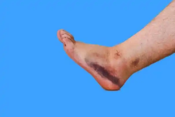 脚踝训练的关键因素主要有以下几点