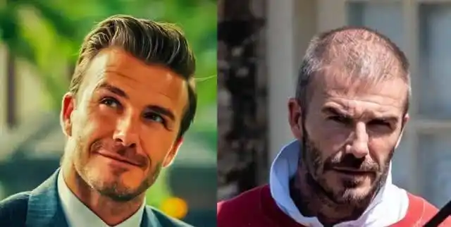 太秃然!再帅气也逃不掉秃头的10大男明星,第八位掩饰40多年