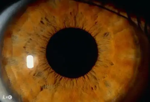 手诊面诊色诊如何通过虹膜学来诊断健康