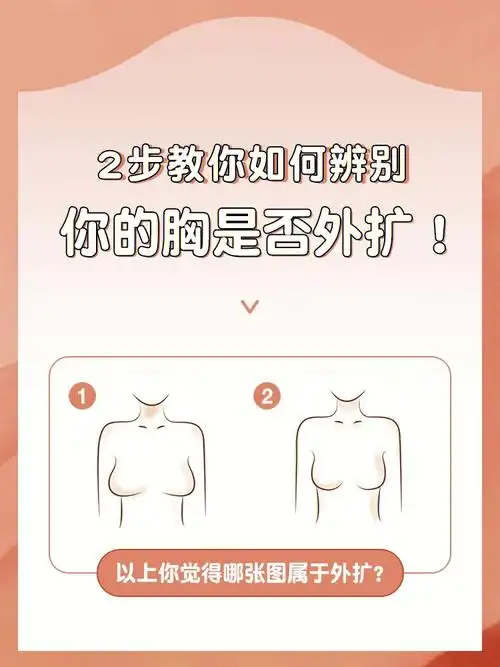 2步教你辨别你是否胸外扩‼️