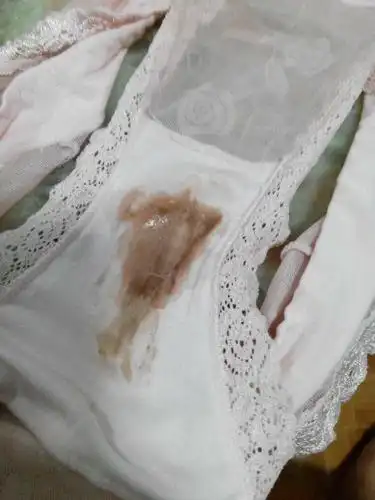 月经来完第11天,这几天下面总是流出一些棕色的分泌物,有时候是液态