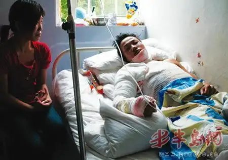 烧伤的小杨(右)浑身缠满了绷带