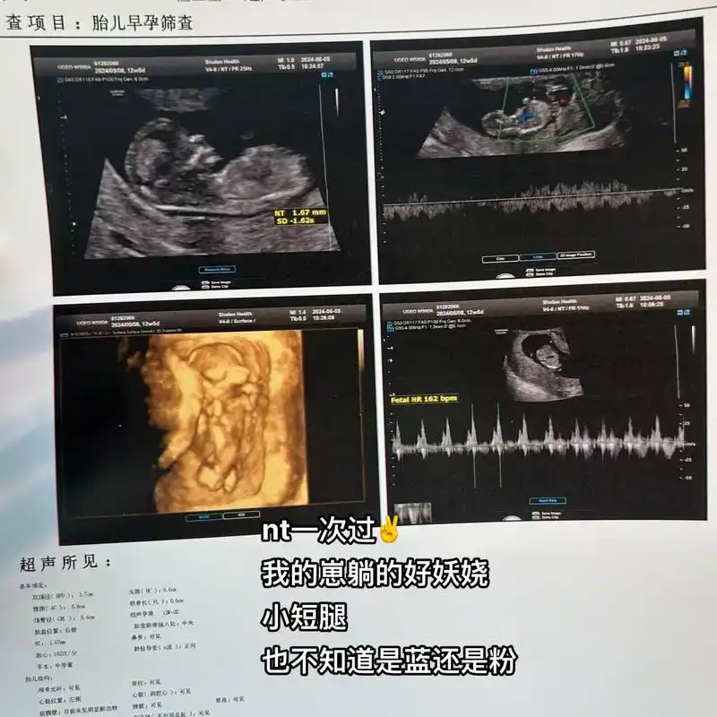 nt一次过了7015 小短腿躺的好妖娆 也不知道是蓝还是粉