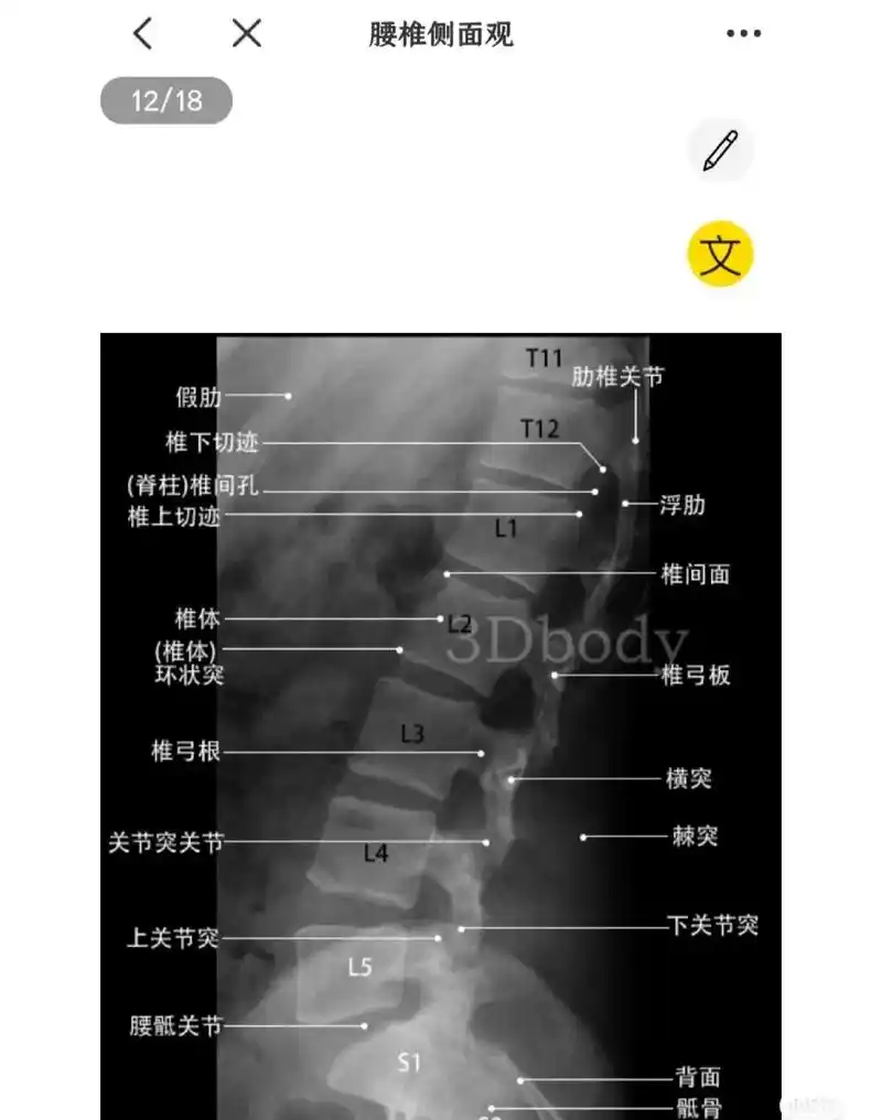 腰椎,胸椎,骶尾椎正侧位x线解剖.这个系列各个部位的详细解剖 - 抖音