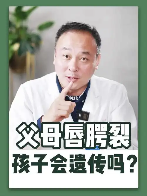 关于唇腭裂会不会遗传这件事