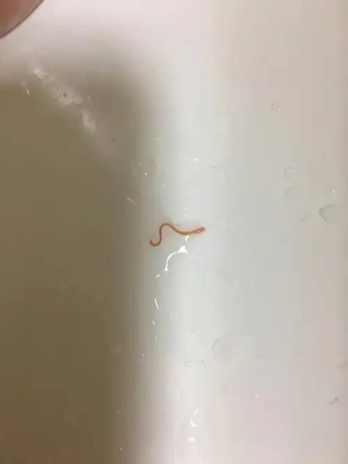 阴道红色半透明的虫子 会动像蚯蚓 怎么回事