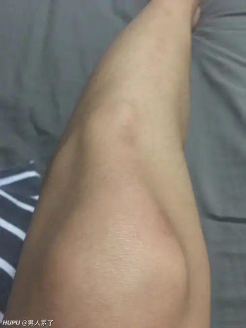 膝盖下方骨头凸起痛是怎么回事